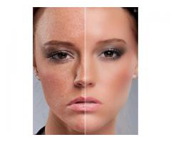 Skin Care Creams call/sms/whatsapp 0630735753