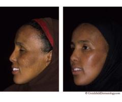 Skin Care Creams call/sms/whatsapp 0630735753