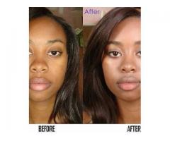 sinai Royal lightening and whitening products