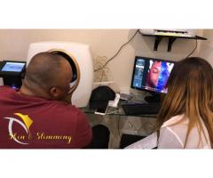Acne Laser Treatment Cost In South Africa