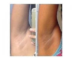 Rollyhampy skin lightening / bleaching products