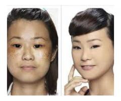 Rollyhampy skin lightening products consist of unique safe ingredients