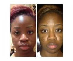 New Improved Skin care Treatments